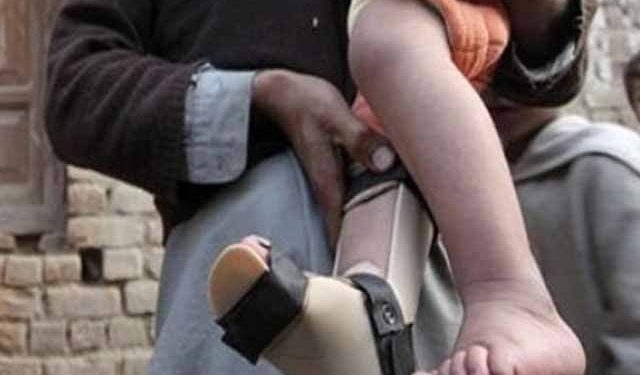 پولیو نے چاروں صوبوں کو لپیٹ میں لے لیا
