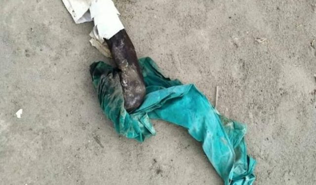 بریکنگ نیوز ۔ لیہ غلہ منڈی میدان سے کٹی ہو ئی انسانی ٹانگ برآمد